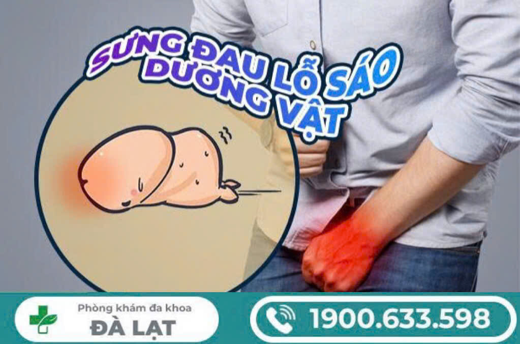 Hình ảnh minh họa